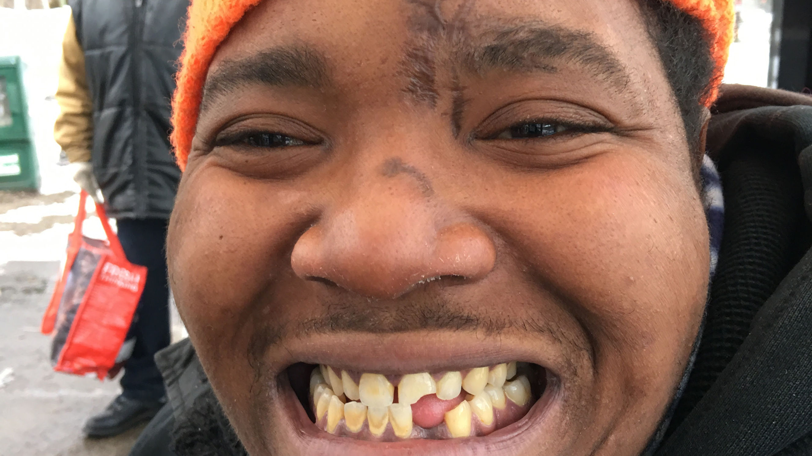 Second Channel